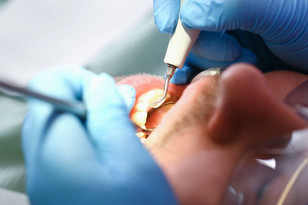 Best Emergency Treatment for Oral Infections in Olive Hill, KY