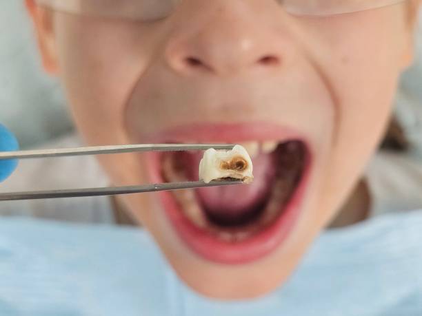 Best Walk-In Emergency Dental Services in Olive Hill, KY